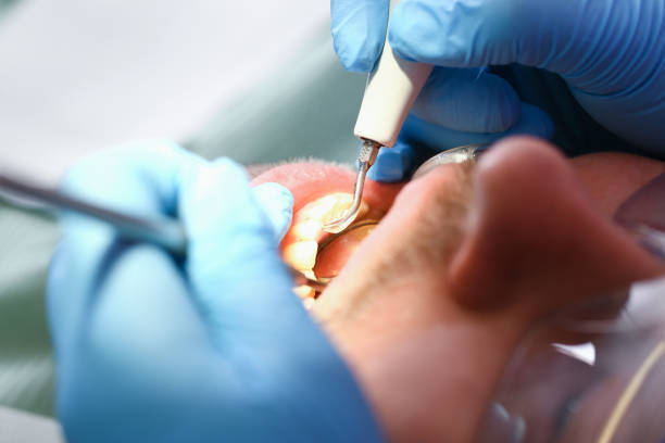 Best After-Hours Dental Care in Monrovia, IN