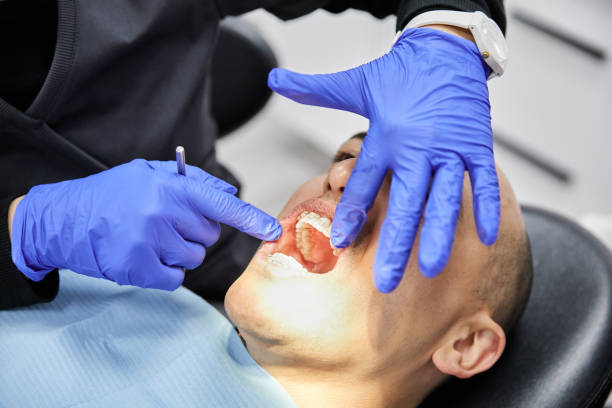 Best Broken or Chipped Tooth Repair in Monrovia, IN
